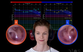 Ottoscreen's hearing measuring system