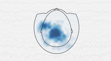 Layout of a magnetoencephalography helmet viewed from the top with blue activation area marked in the middle. Continuous rhythmi